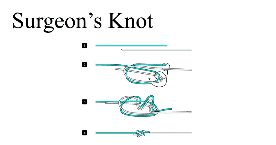 Surgeon’s Knot